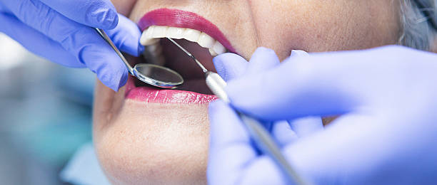 Best Knocked-Out Tooth Emergency  in Teutopolis, IL